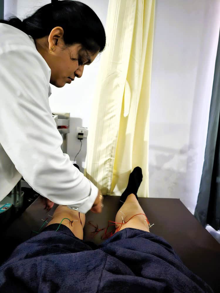 My knees with needles being inserted at Nirvana Naturopathy Retreat